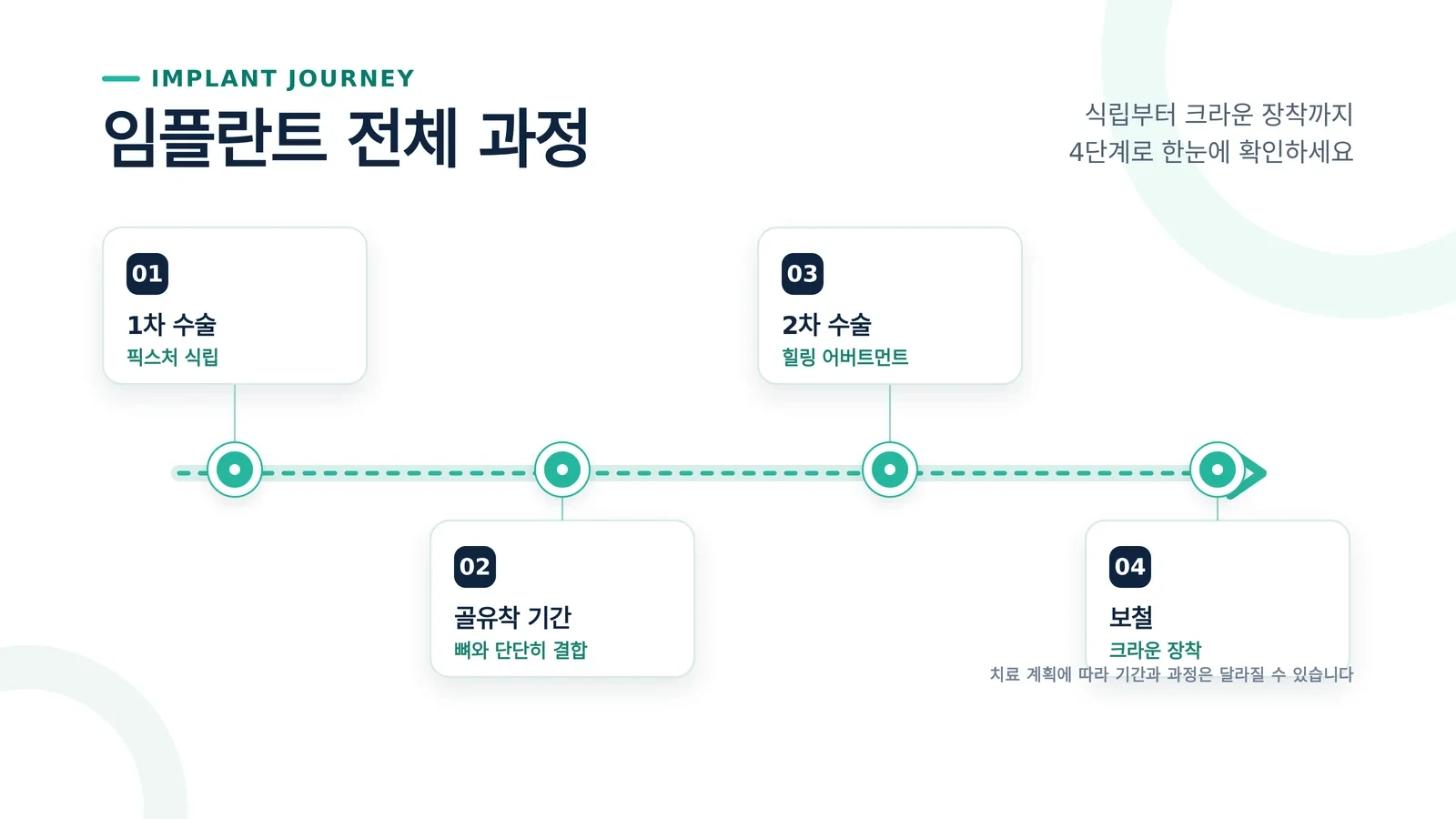 임플란트 보철 과정 상담과 확인 과정